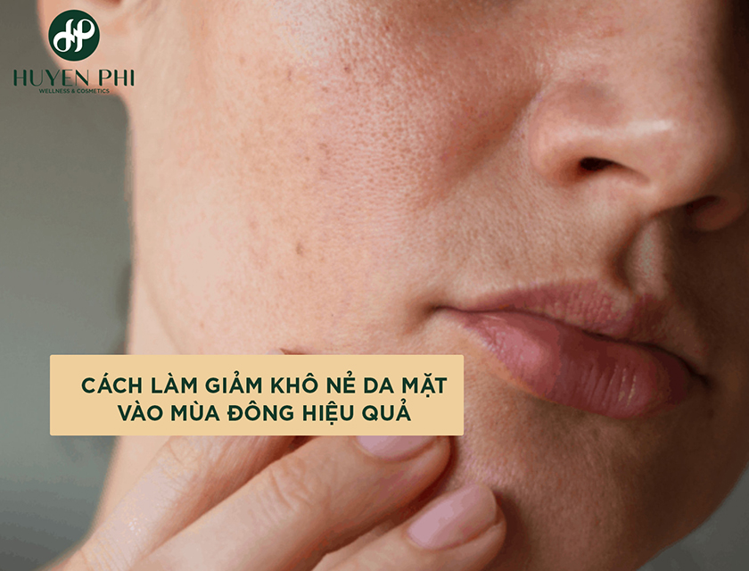 cách giảm khô da mặt