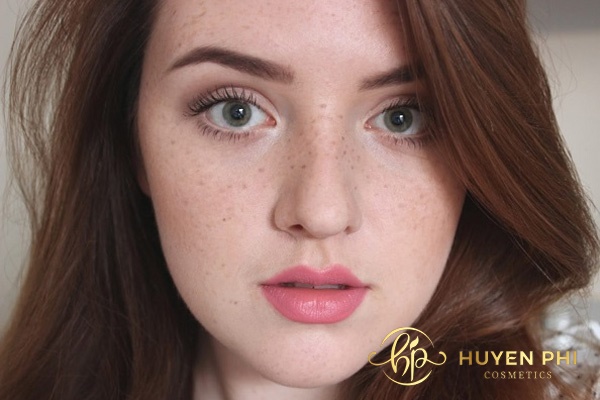 Da mặt không đều màu khiến chị em mất tự tin trong cuộc sống 