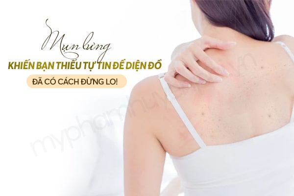 Mụn lưng khiến bạn thiếu tự tin để diện đồ, đã có cách đừng lo!