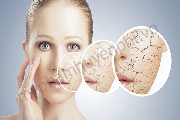 6 Bí quyết để cấp ẩm cho những cô nàng có làn da khô tươi trẻ