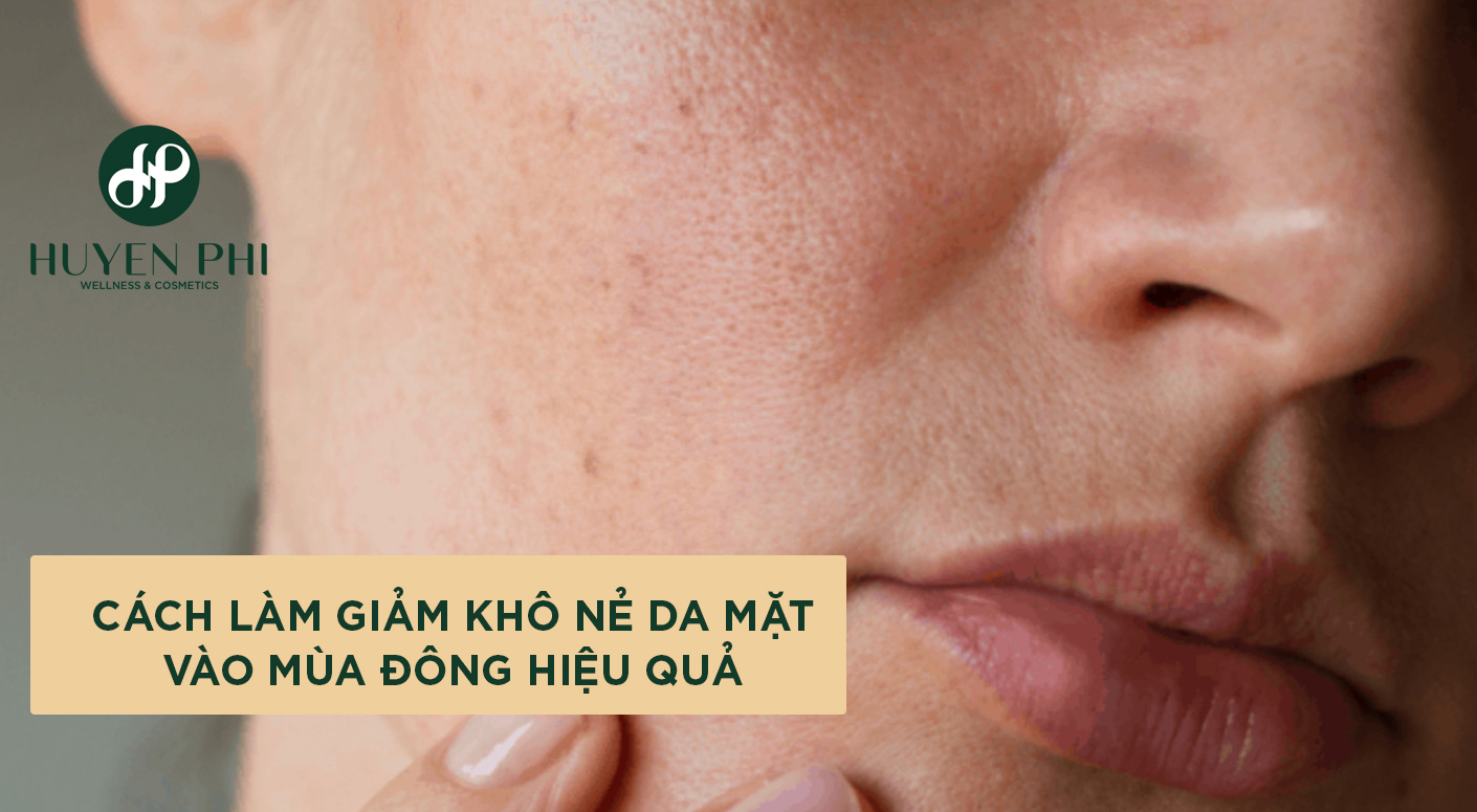 Cách làm giảm khô da mặt vào mùa đông không lo nẻ