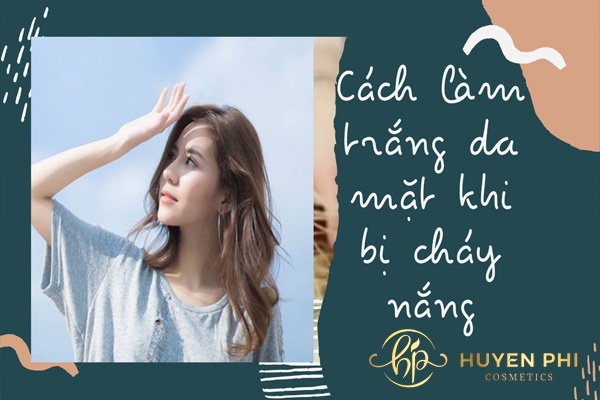 13 cách làm trắng da mặt khi bị cháy nắng hiệu quả nhanh chóng