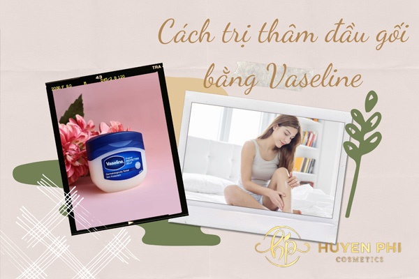 Cách trị thâm đầu gối bằng Vaseline nhanh chóng chỉ với 3 bước