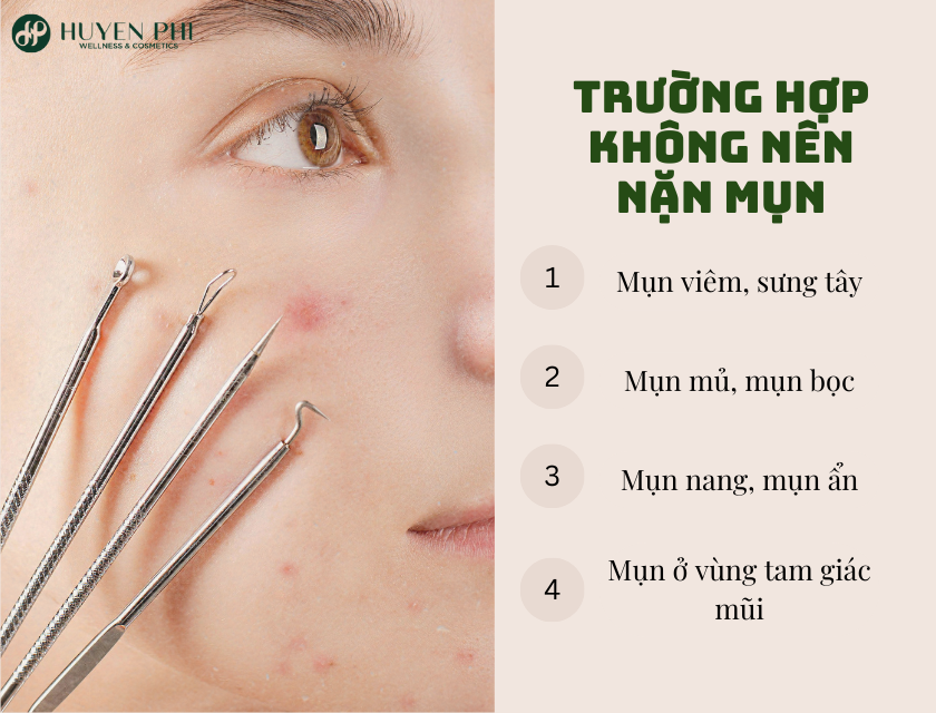 nặn trứng cá