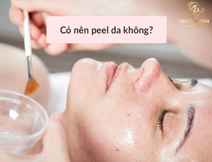 Da khô, yếu, nhạy cảm có nên peel da mặt không?