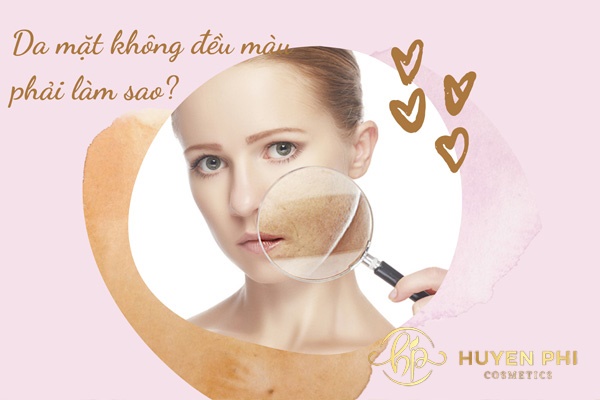 Da mặt không đều màu phải làm sao? 6 bước Skincare cho da xỉn màu