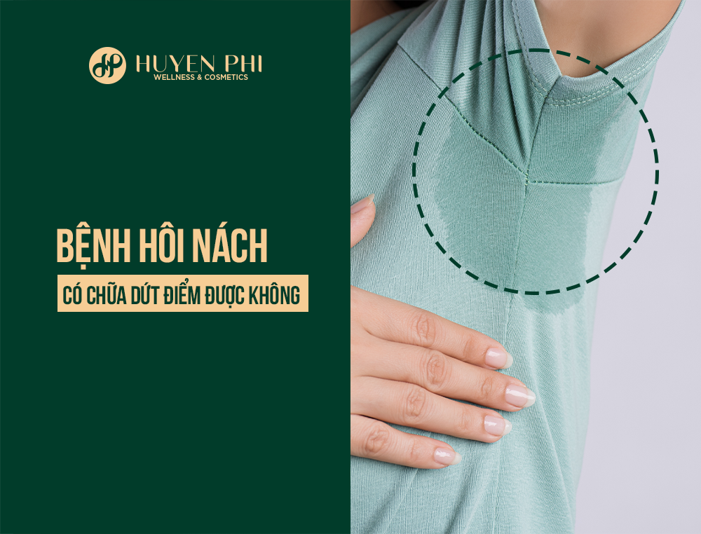 hôi nách có trị dứt điểm được không