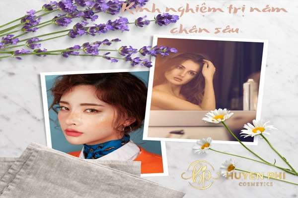 Những kinh nghiệm trị nám chân sâu hiệu quả bạn nên áp dụng ngay