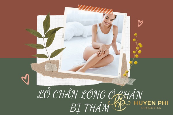 Lỗ chân lông ở chân bị thâm - Nguyên nhân và cách trị
