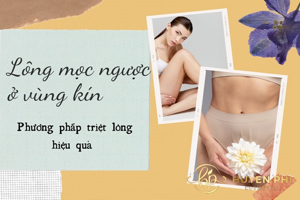 Cách trị lông mọc ngược ở vùng kín hiệu quả an toàn cho cô bé