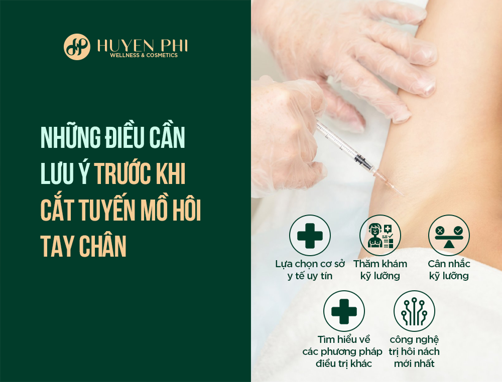 cắt tuyến mồ hôi tay chân