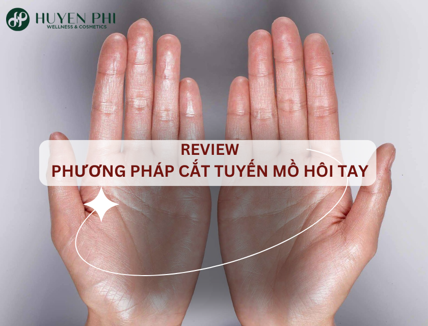 Review cắt tuyến mồ hôi tay chân giá bao nhiêu, bệnh viện nào?