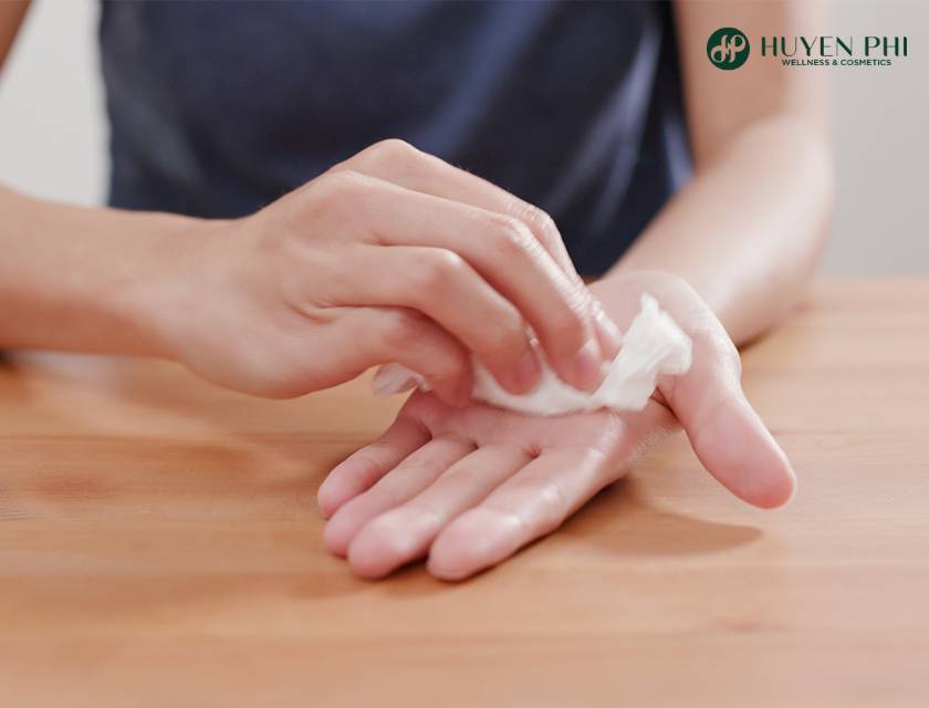 chi phí cắt tuyến mồ hôi tay chân