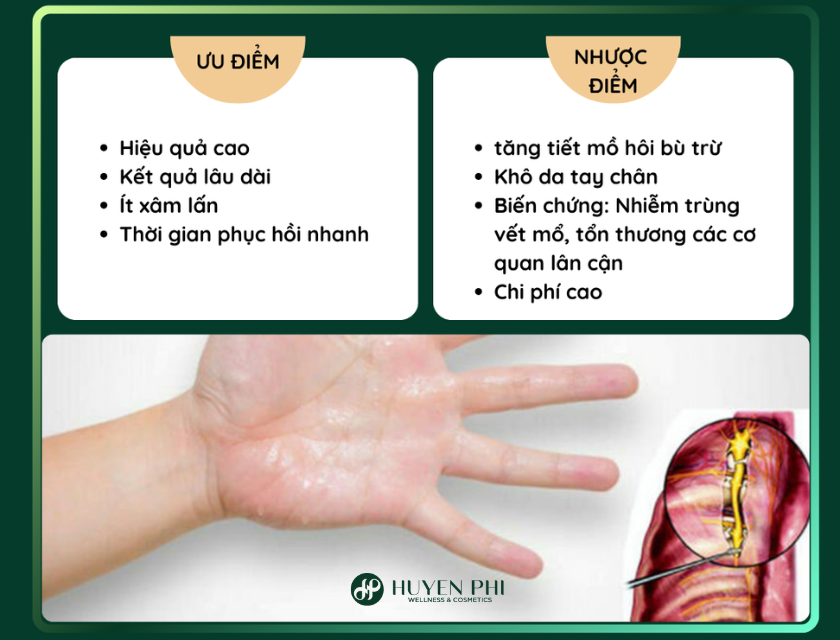 cắt tuyến mồ hôi tay chân giá bao nhiêu