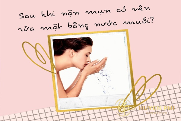 Sau khi nặn mụn có nên rửa mặt bằng nước muối không? Cần lưu ý gì