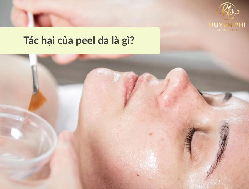 Peel da có hại không? Tác hại của peel da có nguy hiểm không?