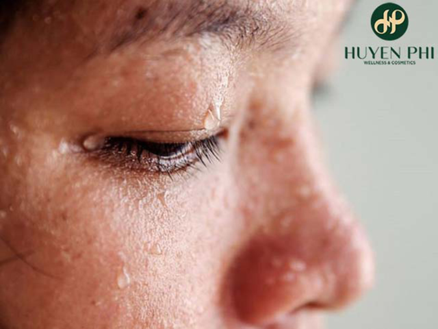 Thoa kem mặt, body bị đổ mồ hôi phải làm sao?