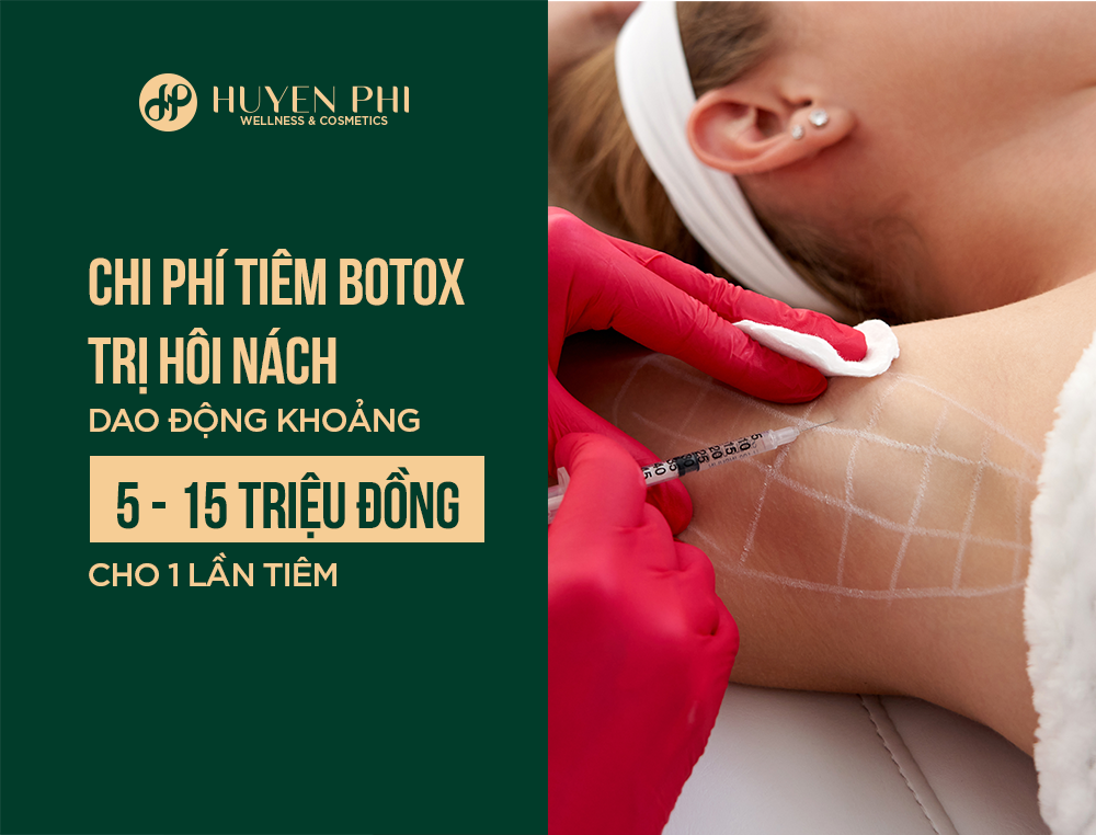 tiêm botox trị hôi nách giá bao nhiêu