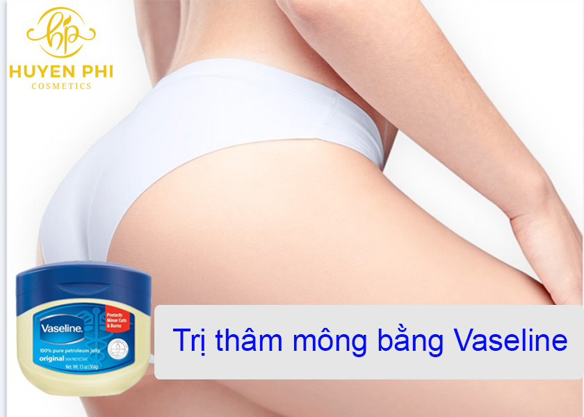 Cách trị thâm mông bằng Vaseline đơn giản, hiệu quả tại nhà