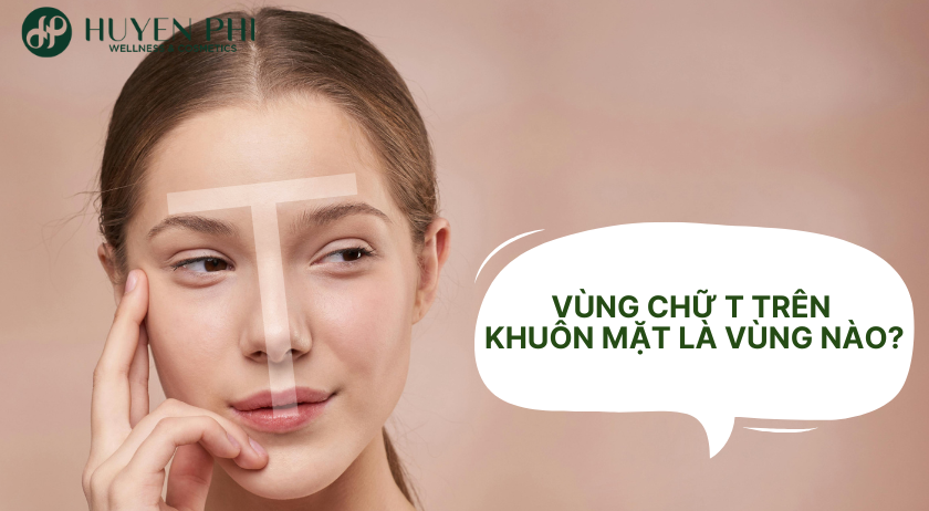 Vùng chữ T trên mặt là vùng nào? Cách trị mụn vùng chữ T