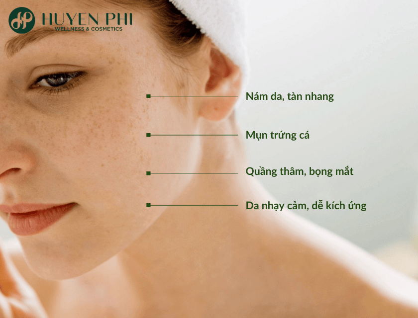 cách chăm sóc da mặt sau sinh