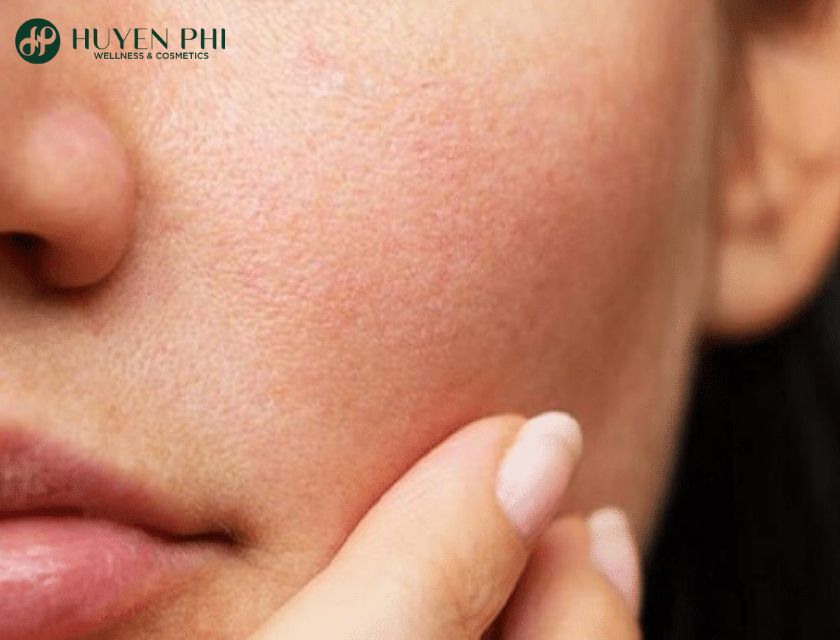 như thế nào là da dầu và da khô