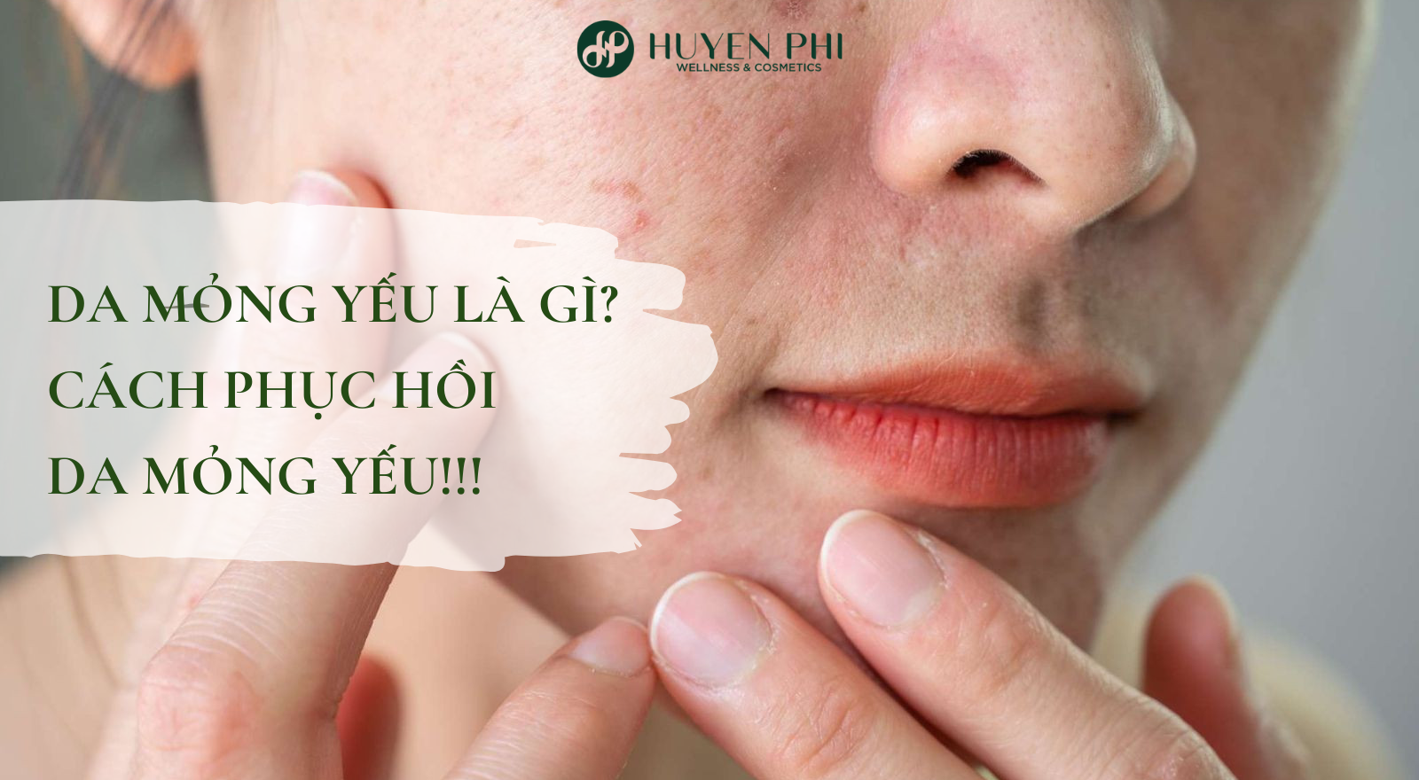 Da mỏng yếu là gì? Cách phục hồi da mỏng yếu