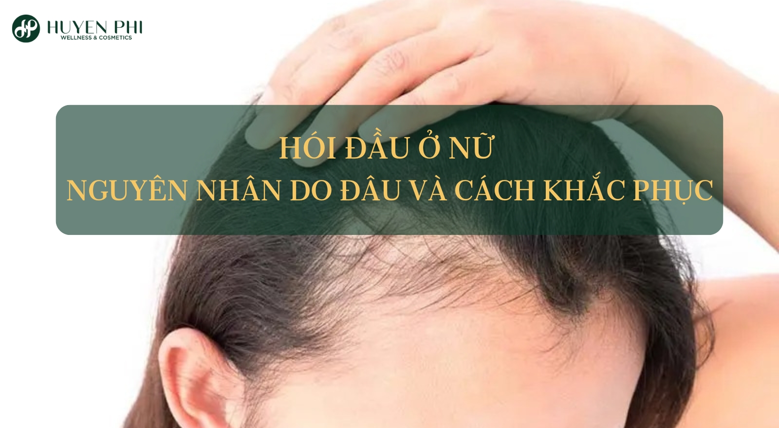 Hói đầu ở nữ: Nguyên nhân do đâu và cách khắc phục