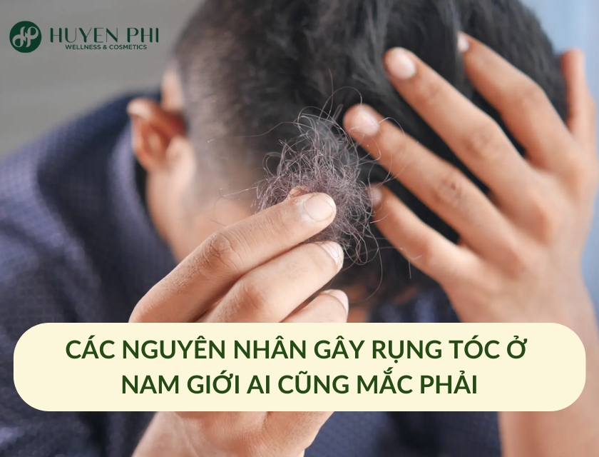 nguyên nhân rụng tóc ở nam