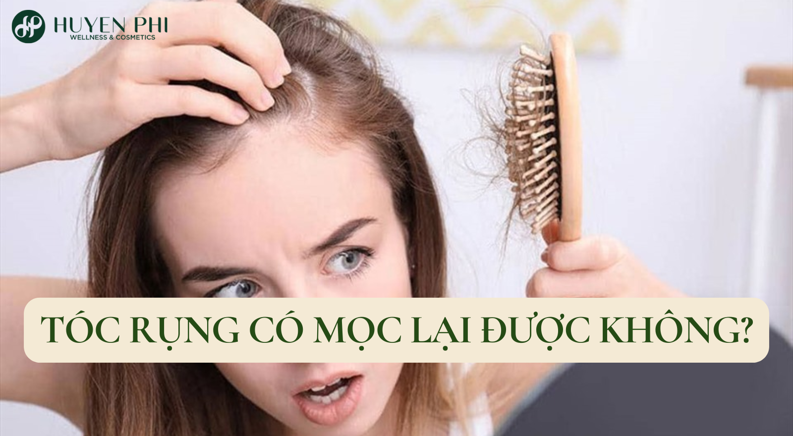 Tóc rụng có mọc lại được không? Nguyên nhân gây rụng tóc
