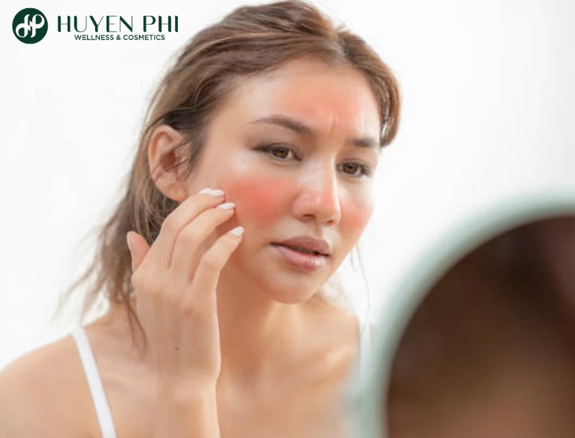 da bị cháy nắng có phục hồi được không