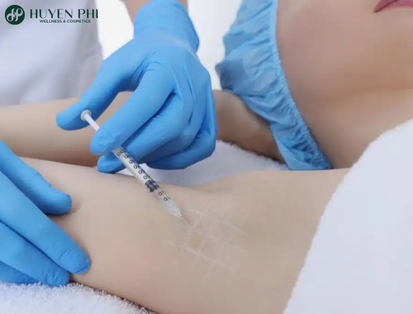 Cach De Khong Bi Chay Mo Hoi Nach 3