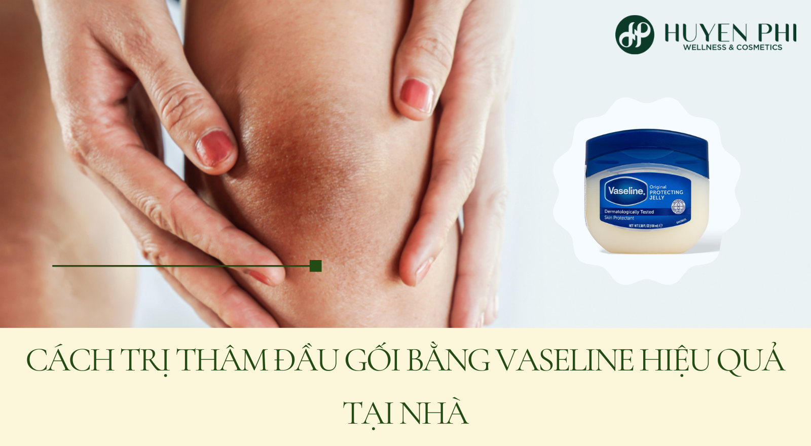 Cách trị thâm đầu gối bằng Vaseline hiệu quả tại nhà