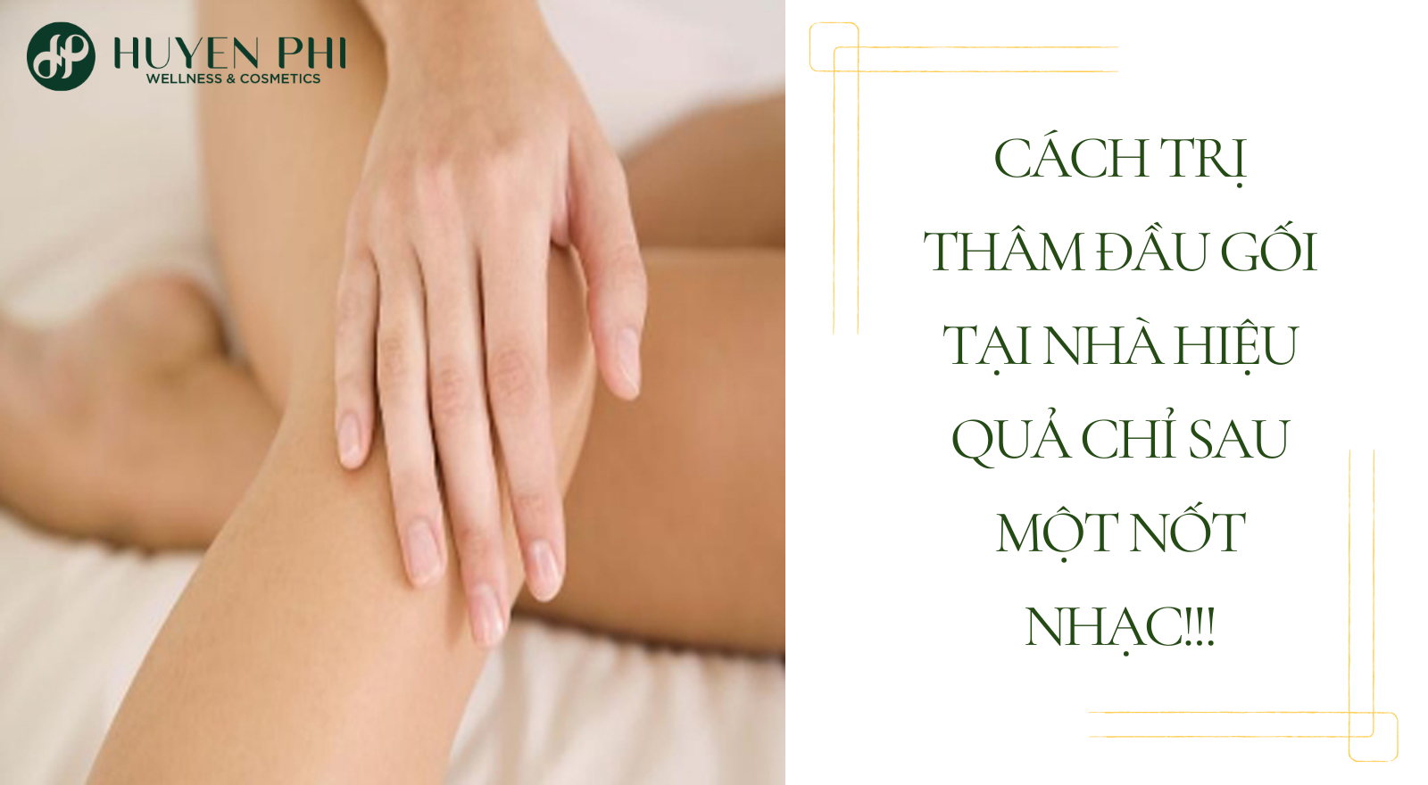 Cách trị thâm đầu gối tại nhà hiệu quả sau một nốt nhạc