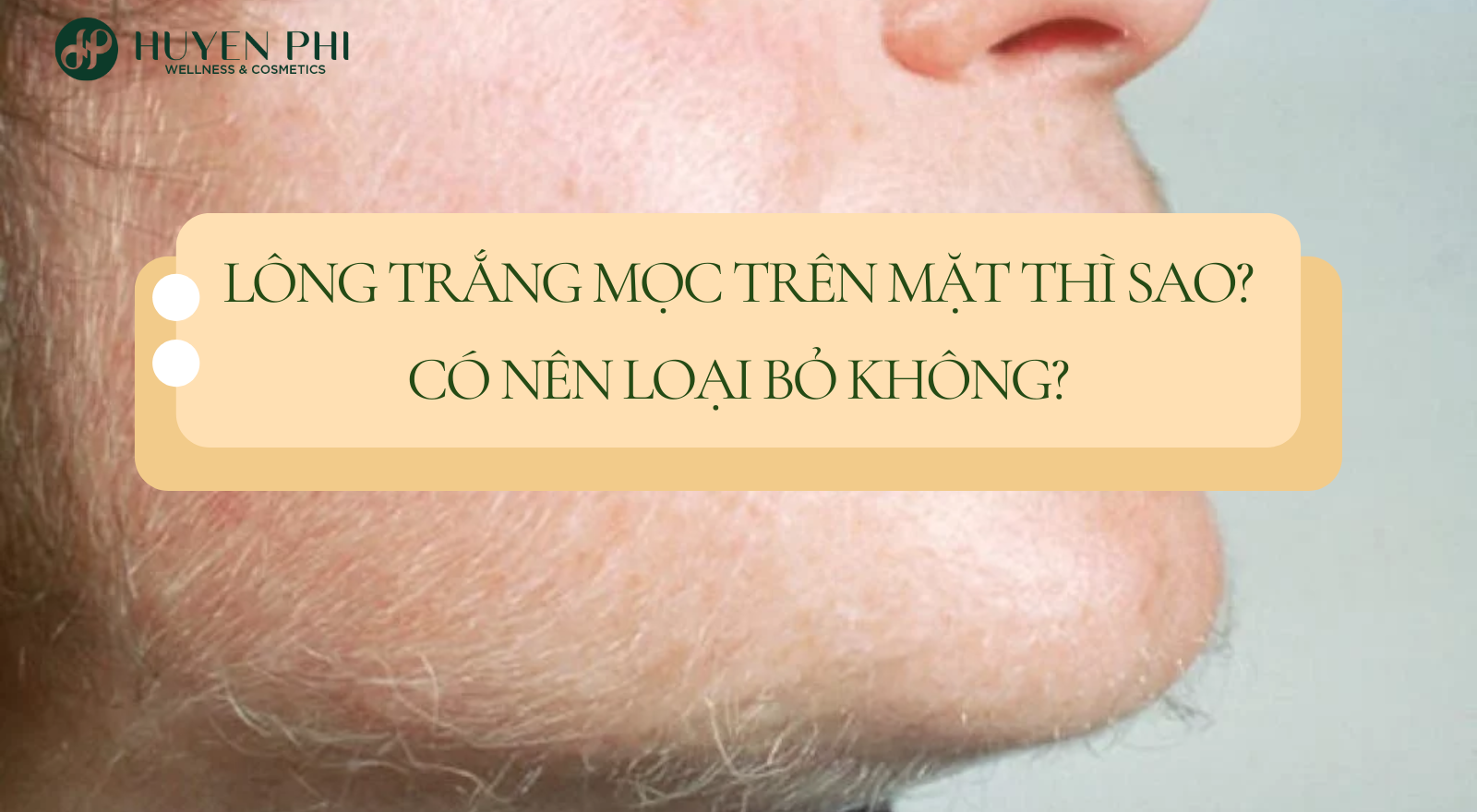 Lông trắng mọc trên mặt thì sao? Có nên loại bỏ không?