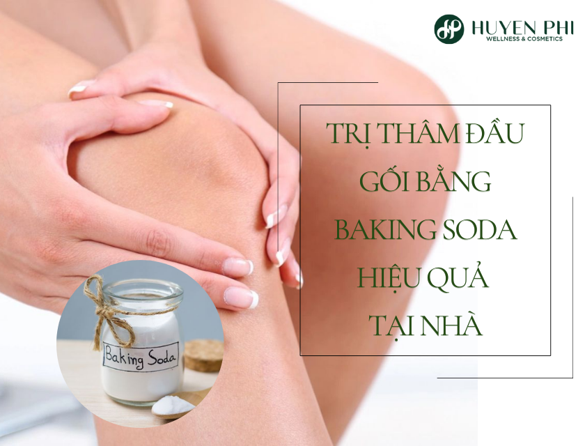 Tri Tham Dau Goi Bang Baking Soda 1