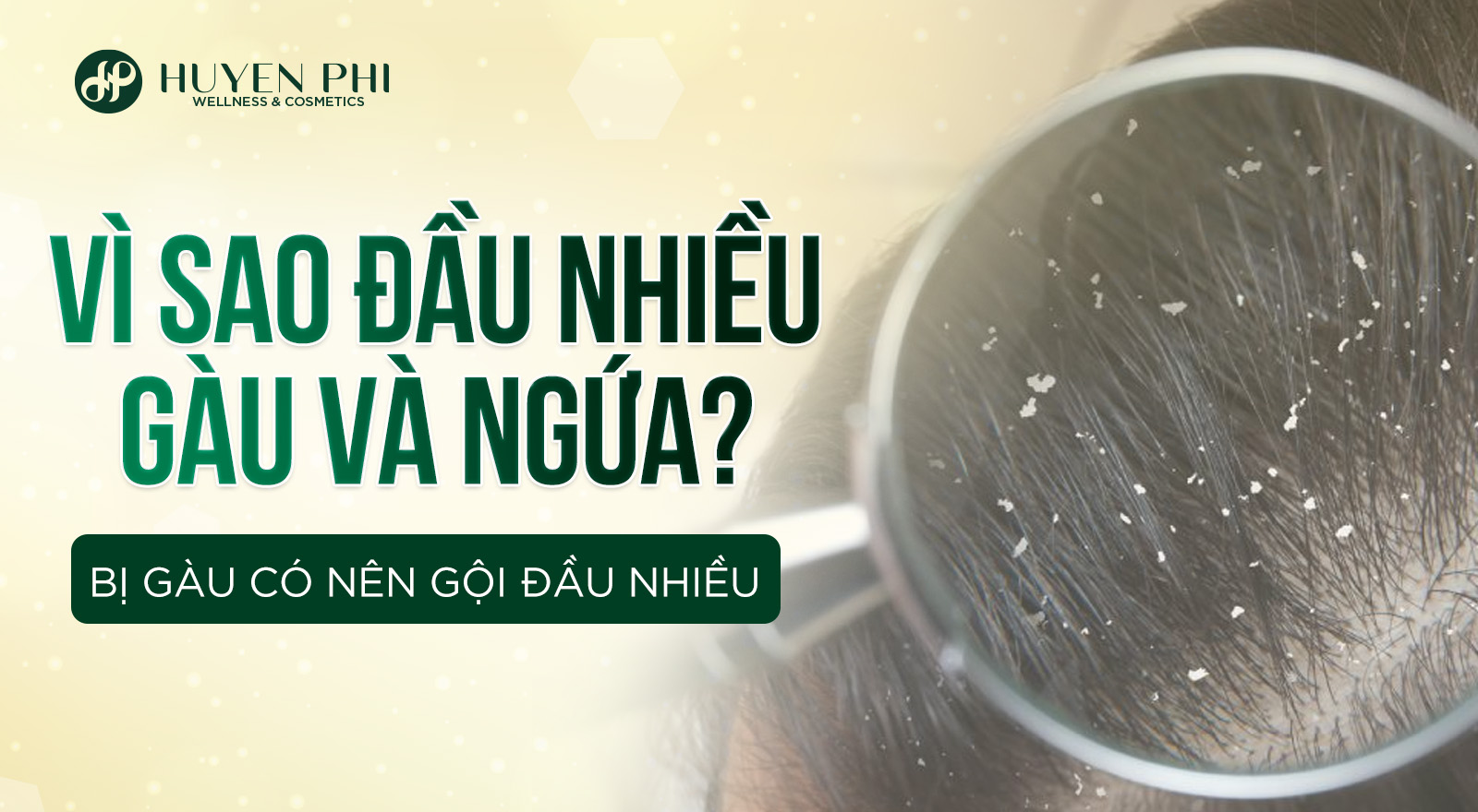 Vì sao đầu nhiều gàu và ngứa? Bị gàu có nên gội đầu nhiều