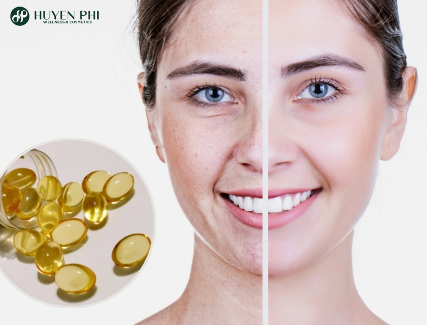 Thoa Vitamin E De Qua Dem 2