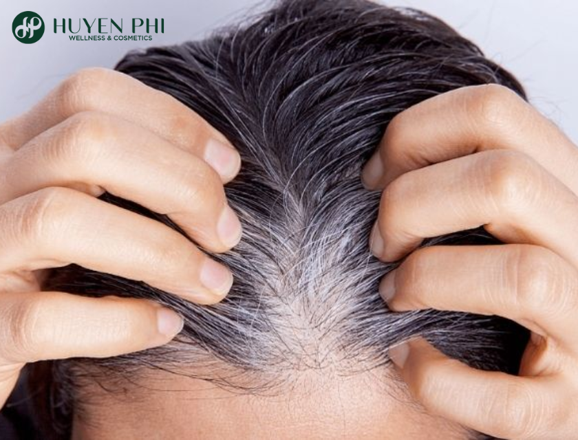 Toc Bac Co Den Lai Duoc Khong 2