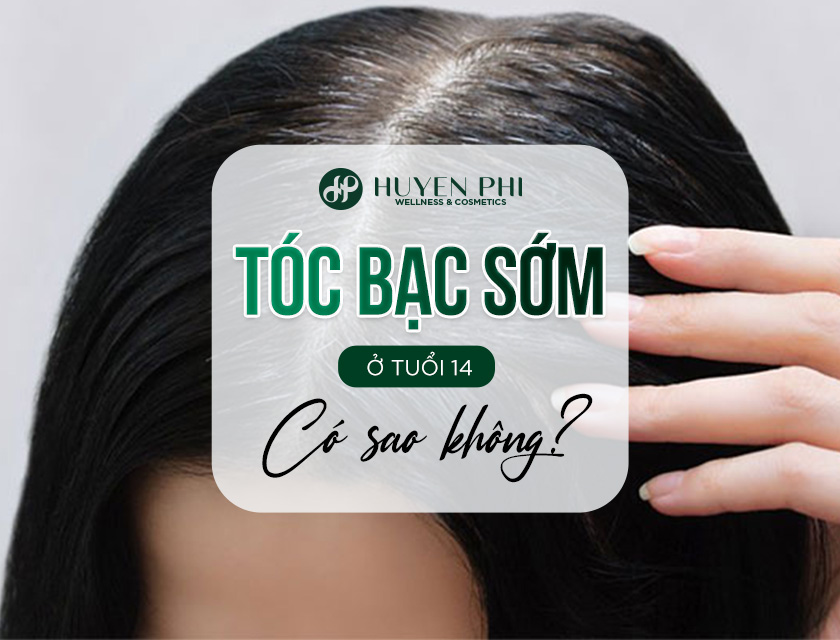 Toc Bac Som O Tuoi 14 Co Sao Khong 1
