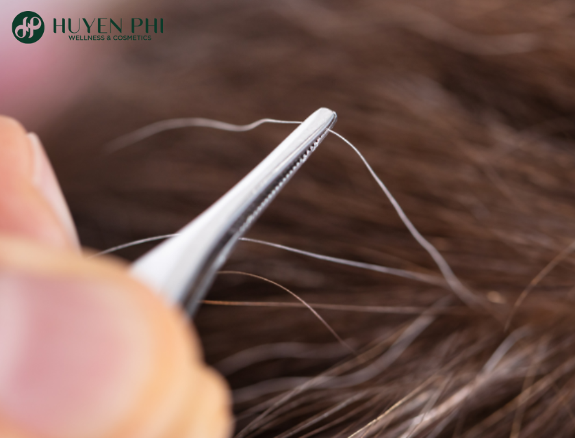 Toc Bac Som O Tuoi 14 Co Sao Khong 4