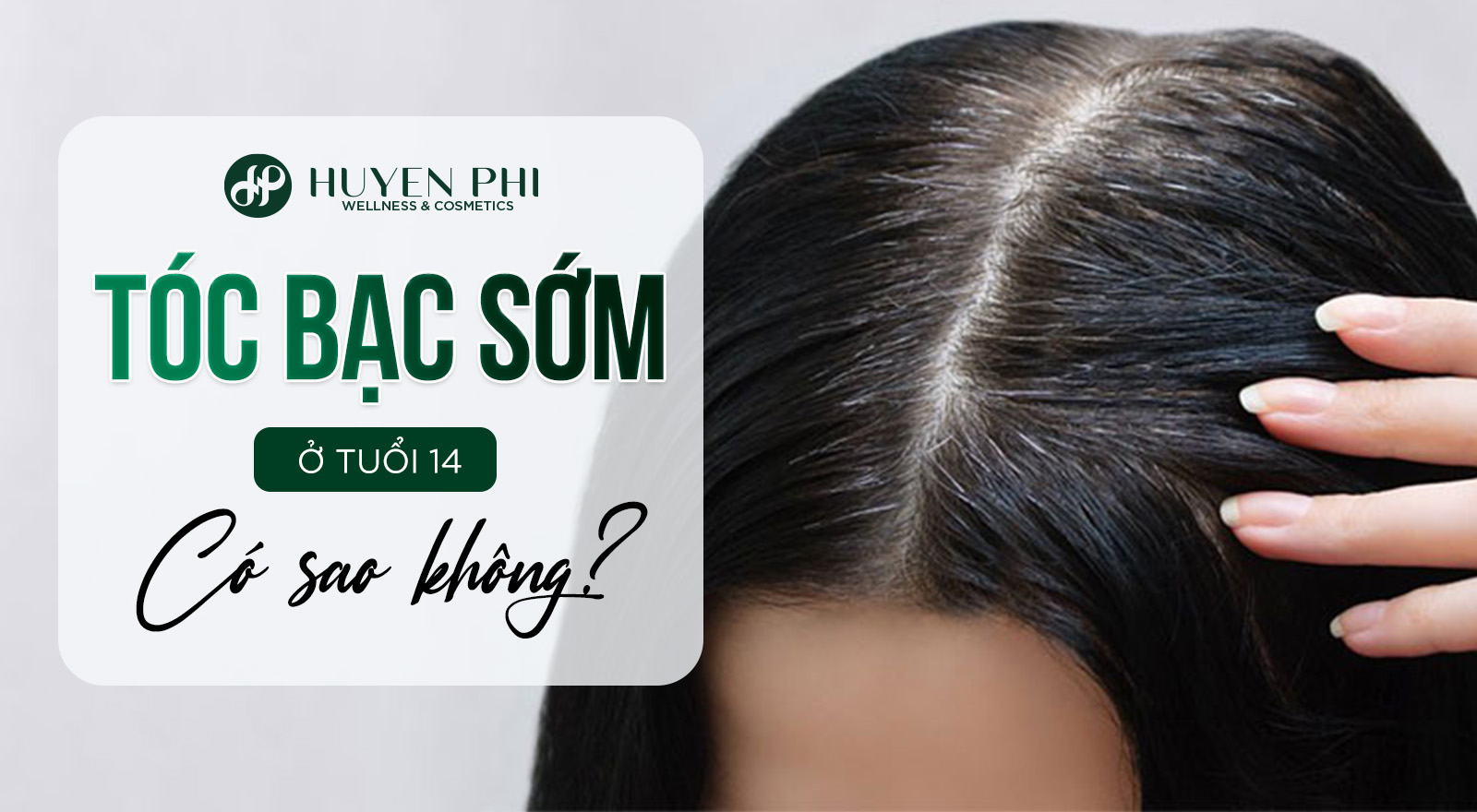 Tóc bạc sớm ở tuổi 14 có sao không?