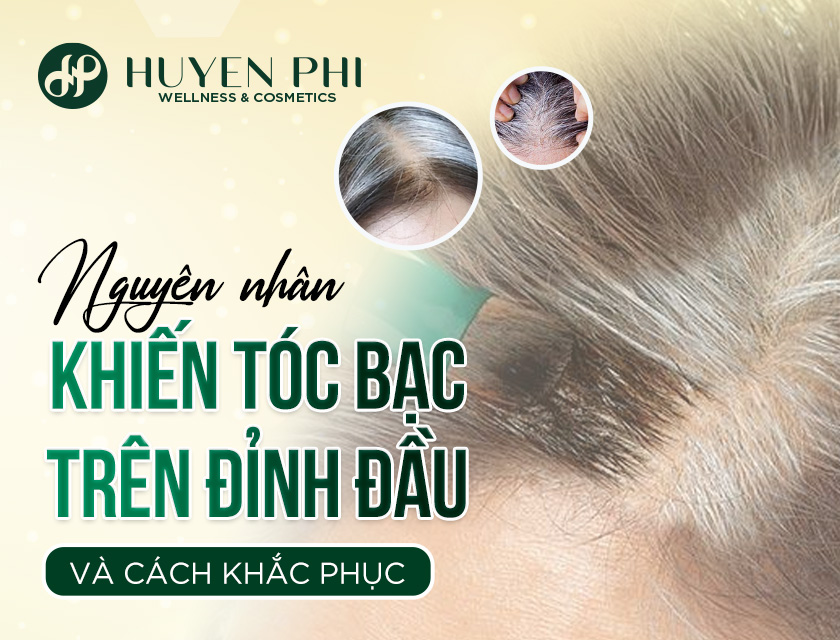 Toc Bac Tren Dinh Dau 1