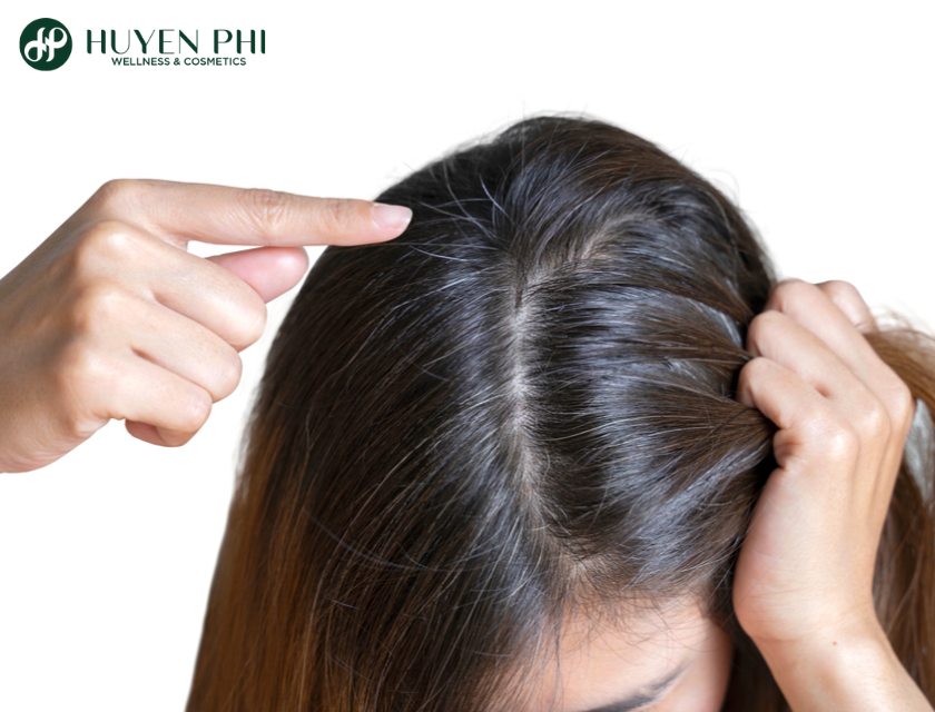 Toc Bac Tren Dinh Dau 2