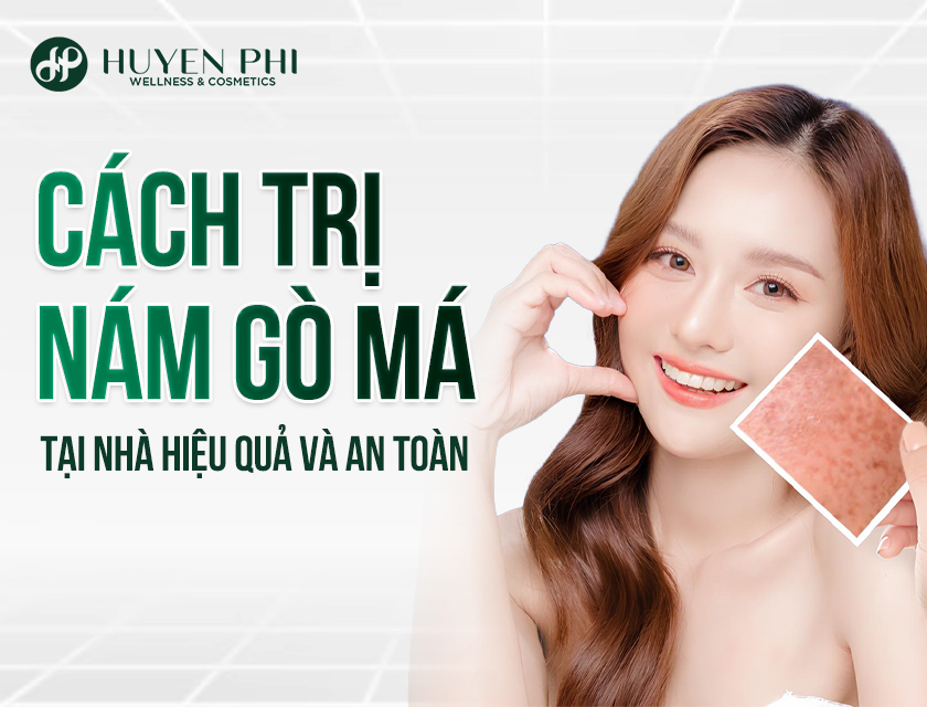 Cach Tri Nam Go Ma Tai Nha 1