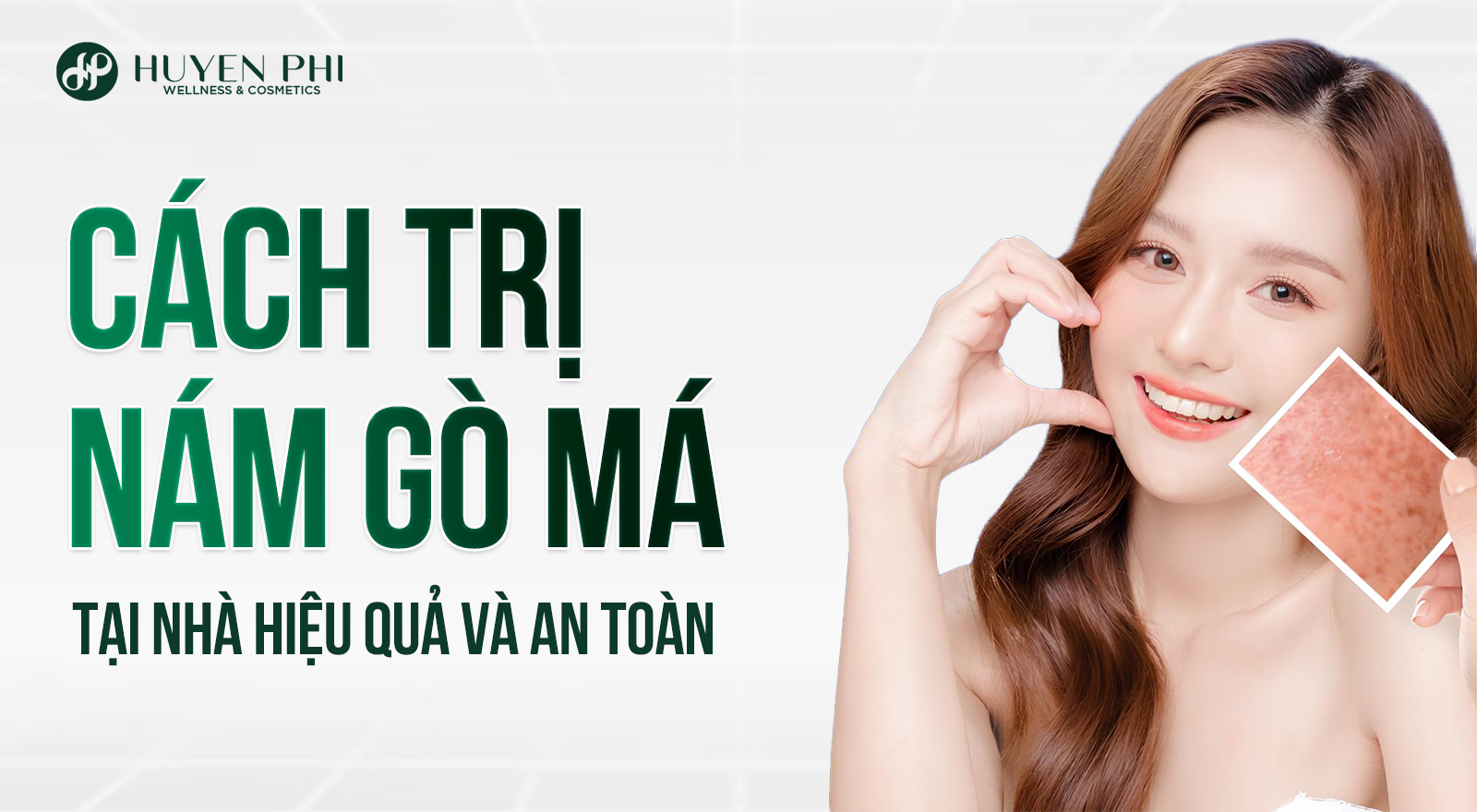 Cách trị nám gò má tại nhà hiệu quả và an toàn
