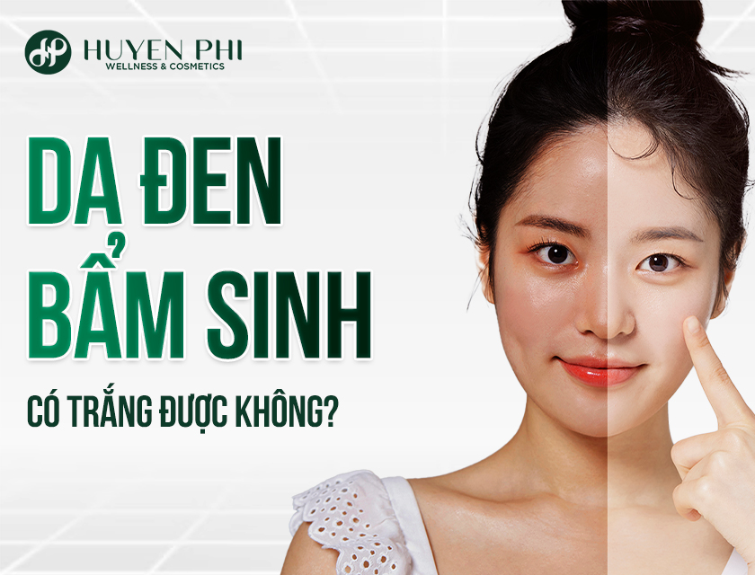Da Den Bam Sinh Co Trang Duoc Khong 1