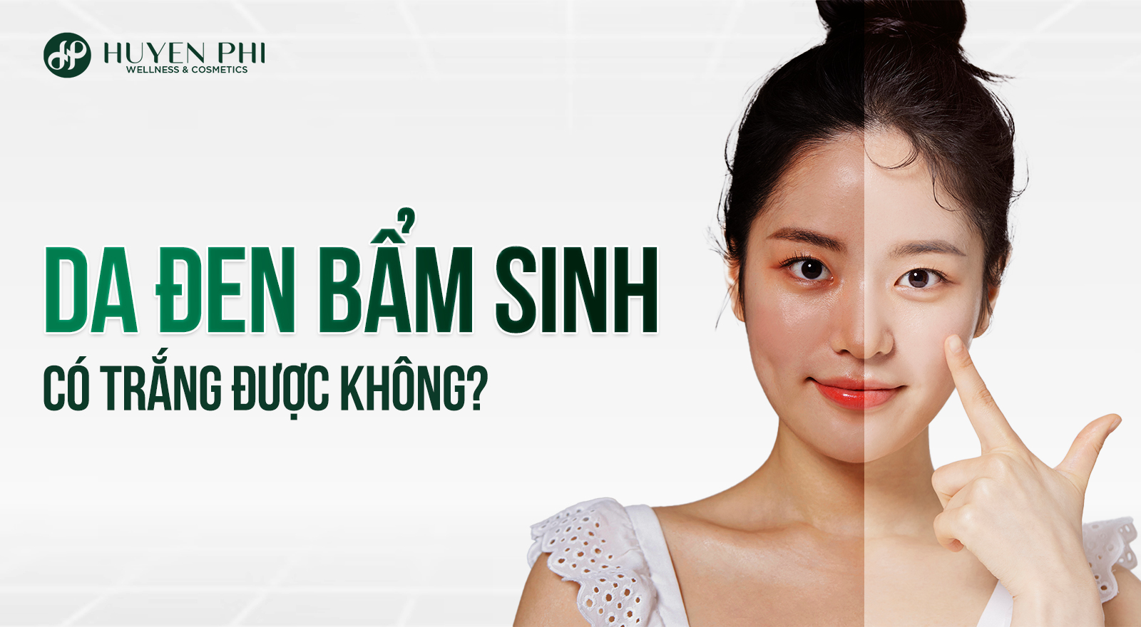 Da đen bẩm sinh có trắng được không? Làm thể nào để trắng da