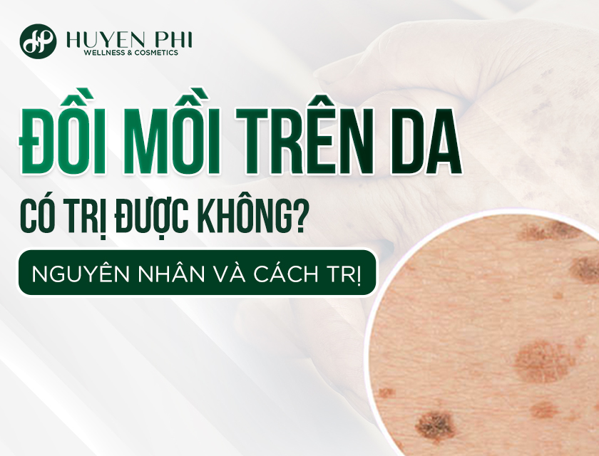 Doi Moi 1