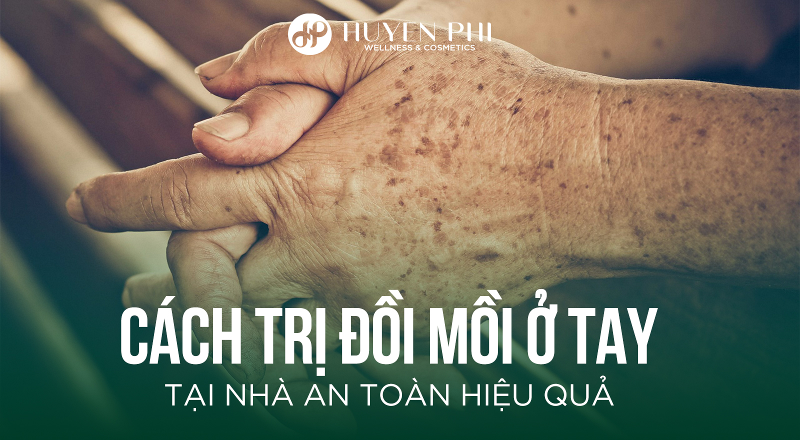 Cách trị đồi mồi ở tay tại nhà an toàn hiệu quả